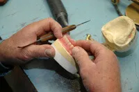 Our cosmetic laboratory work — crowns and veneers crafted with top-tier labs
