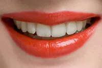 A beautiful, natural-looking smile with dental implants